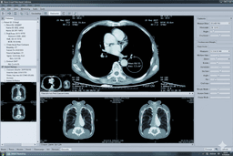 Dicom Viewer project thumbnail - Medical Imaging Management System